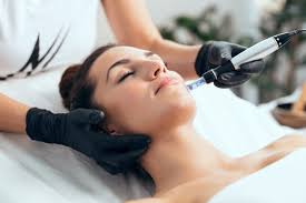 microneedling - Frayla Cosmetic